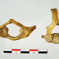 Vertebres cervicales Atlas Axis anterieur (20178 visites) Vertebres cervicales Atlas Axis anterieur