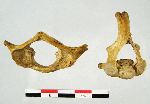Vertebres cervicales Atlas Axis anterieur (20109 visites) Vertebres cervicales Atlas Axis anterieur