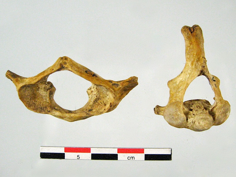 Vertebres_cervicales_Atlas_Axis_anterieur.jpg