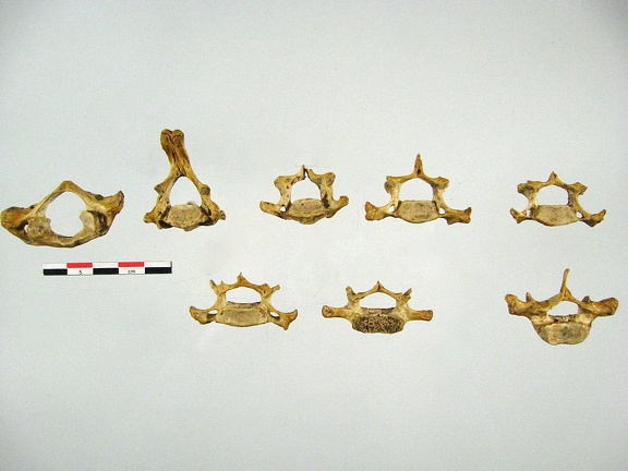 Vertebres cervicales posterieur