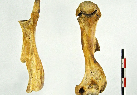 Scapula Humerus lateral