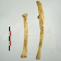 Radius Ulna