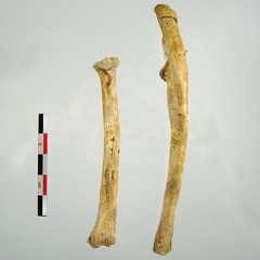 Radius Ulna (22383 visites) Radius Ulna