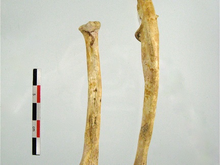 Radius Ulna