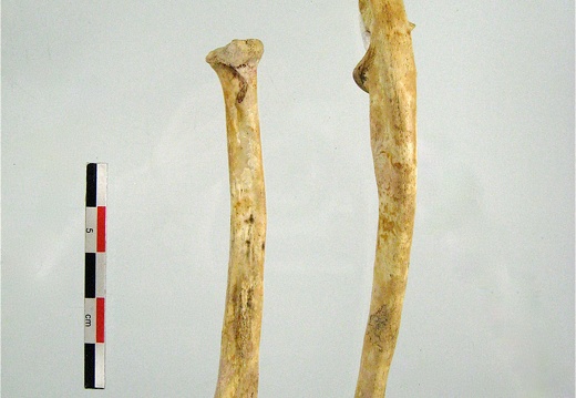 Radius Ulna