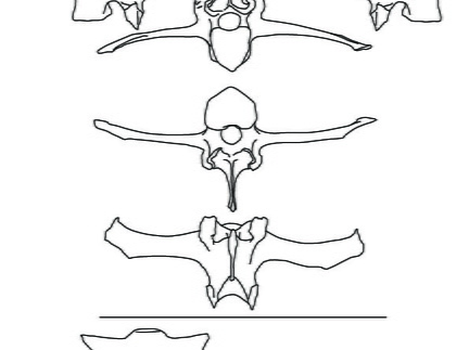 Vertèbres lombaires et sacrum