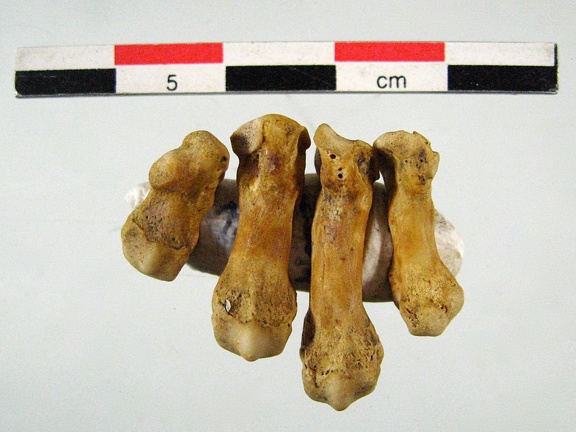 Metacarpes G inversion MC1 MC5 posterieur (38 visits) Metacarpes G inversion MC1 MC5 posterieur