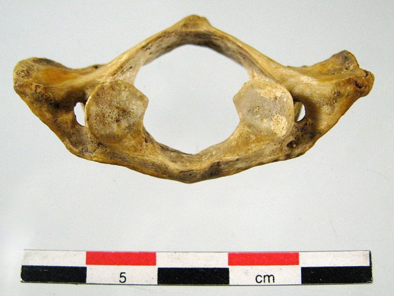 Vertebres cervicales Atlas posterieur (37 visits) Vertebres cervicales Atlas posterieur